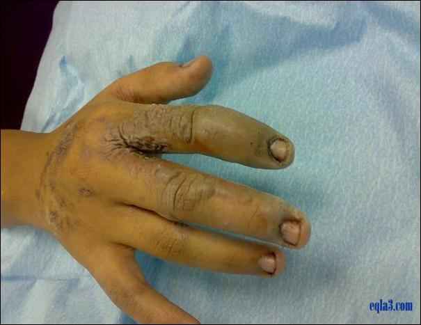 فاجعه مرگ بار بخاطر استفاده نادرست از موبایل در سایت علی نوروزی