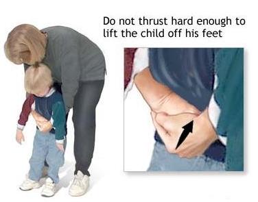 راه نجات انسان از خفگی در اثر بلع با روش مانور هایملیخ (Heimlich Maneuver) در سایت علی نوروزی