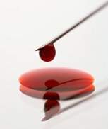 درمان همو فوبیا و ترس از خون در سایت علی نوروزی