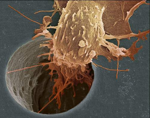 تصویری از حرکت سلول سرطانی در سایت علی نوروزی